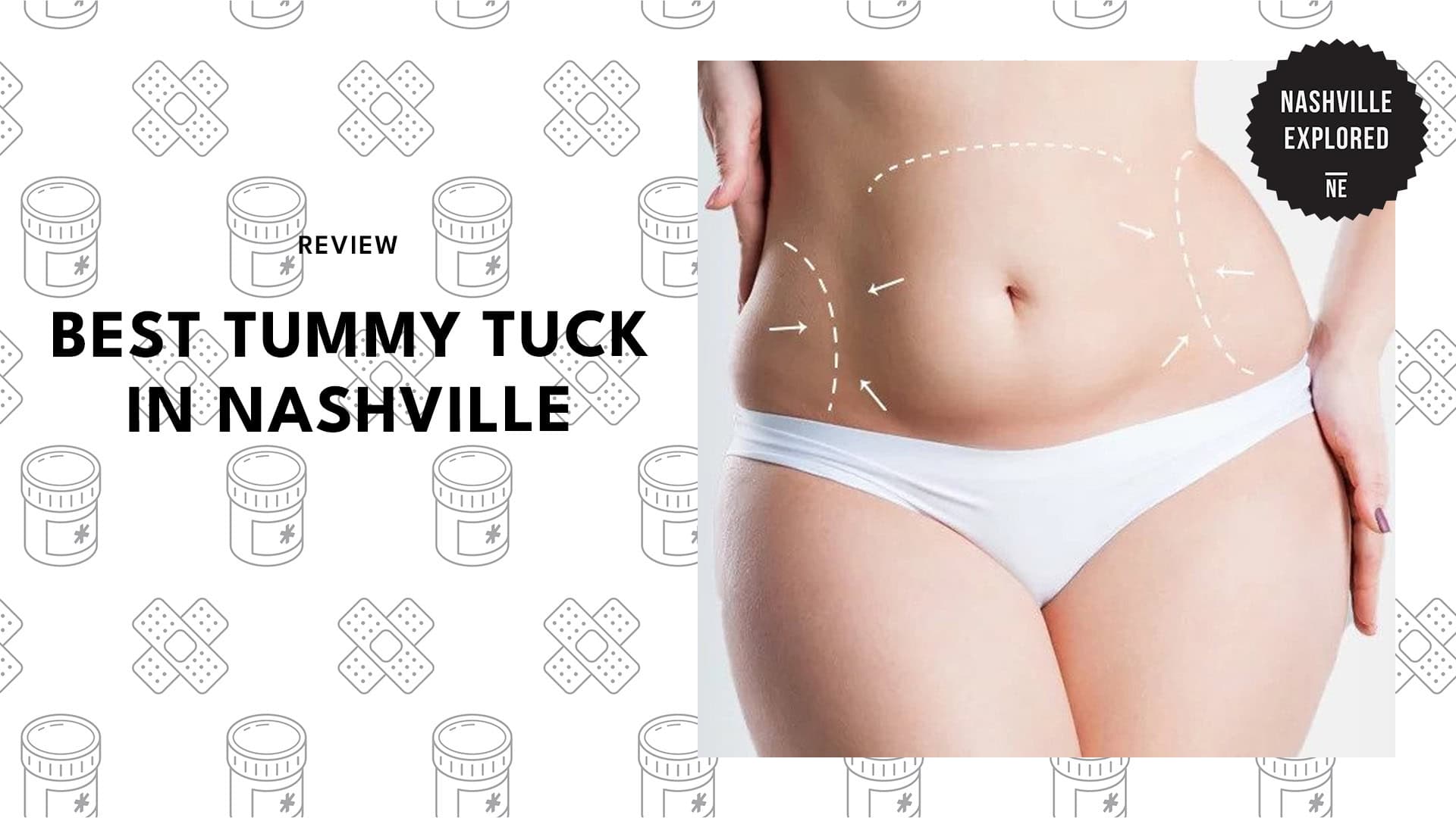 best-tummy-tuck-nashville