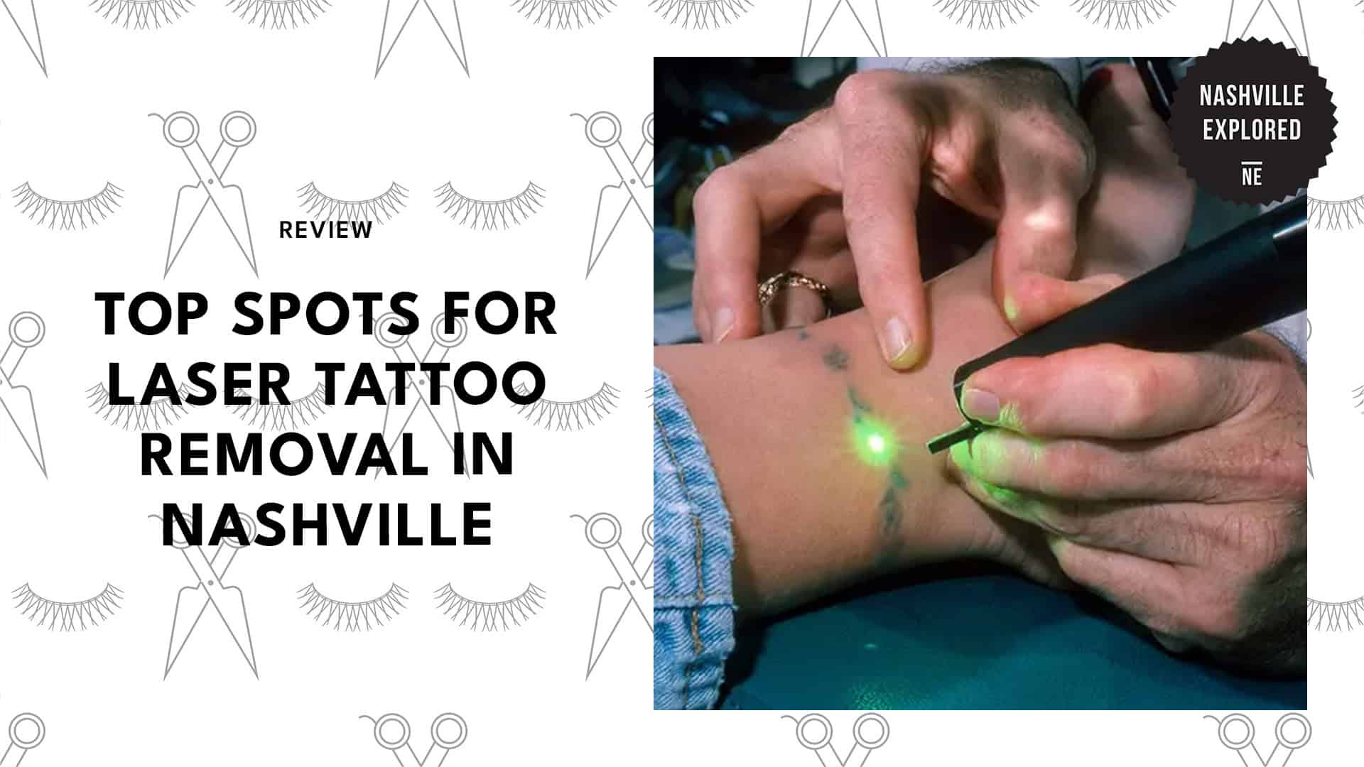 laser-tattoo-removals-in-nashville