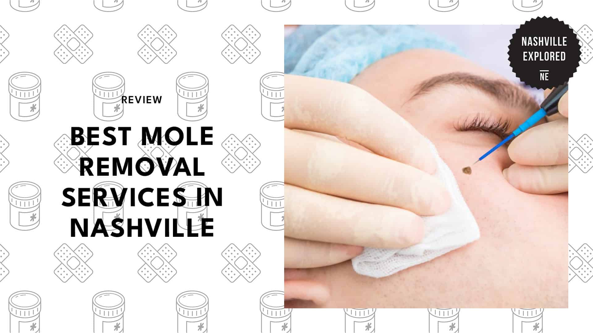 best-mole-removal-nashville
