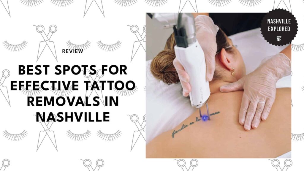 The 5 Best Tattoo Removal Providers in Nashville to Erase Your 2 AM Mistakes 