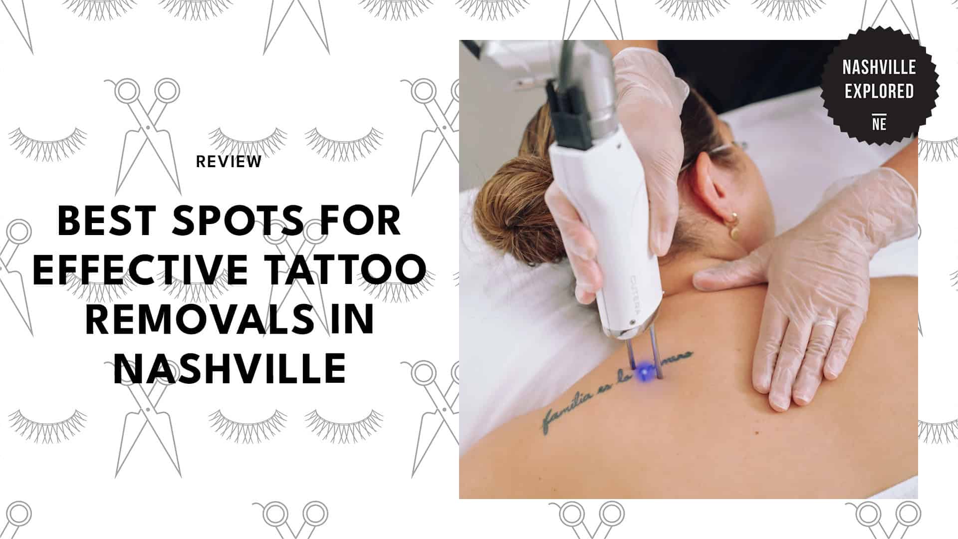 tattoo-removal-providers-in-nashville