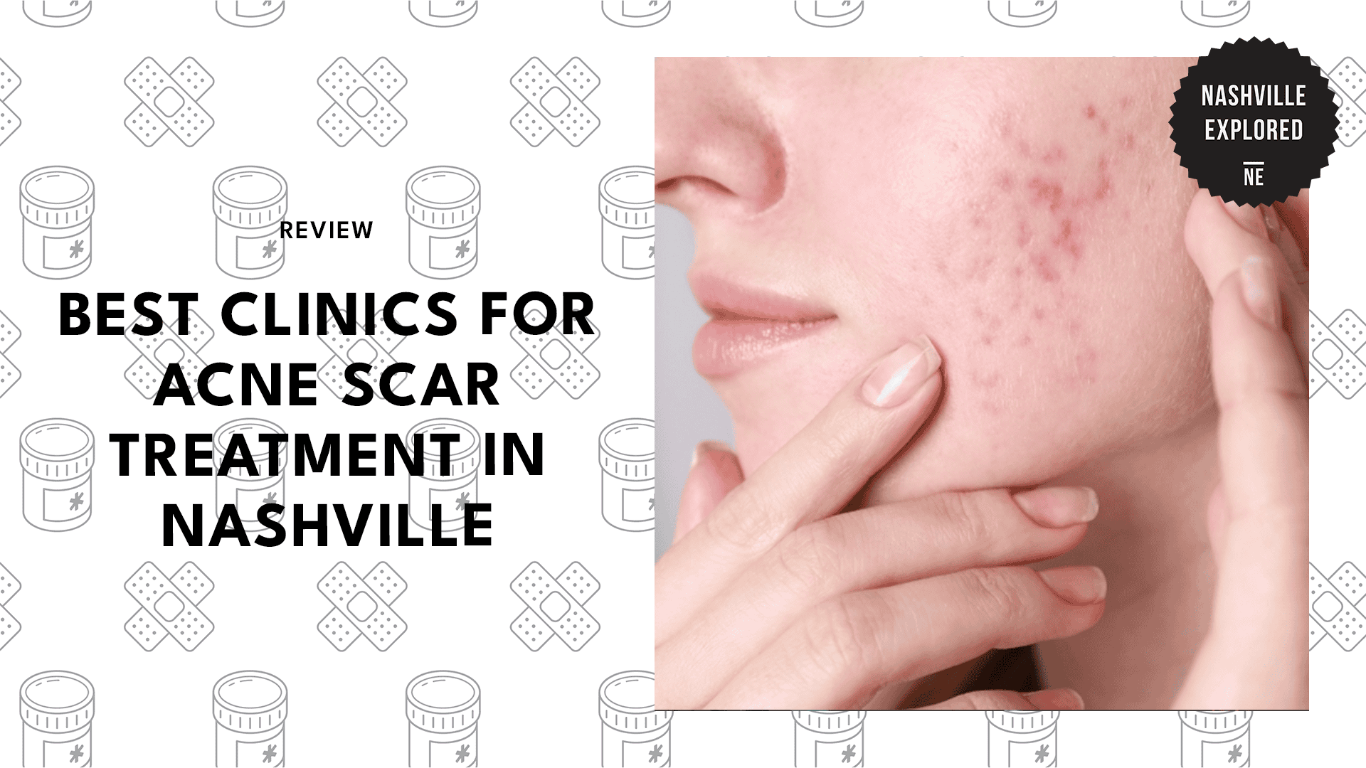 clinics-for-acne-scar-treatment-in-nashville